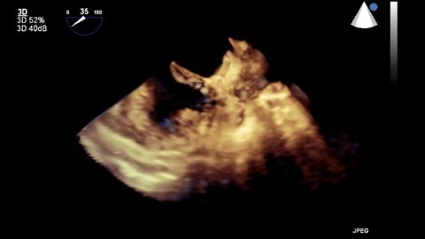 Bidimensional Stock Video Footage 4k And Hd Video Clips Shutterstock Bidimensional Stock Video Footage 4k And Hd Video Clips Shutterstock