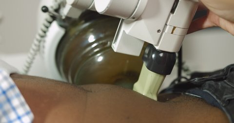 Close up cropped image of lying African man patient having procedure of lithotripsy. Hands of female doctor working with modern ultrasonic lithotripter to crush kidney or ureter stones