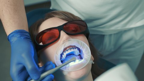 Dentist makes a procedure for teeth whitening. Beautiful smile. Ultraviolet lamp for teeth whitening