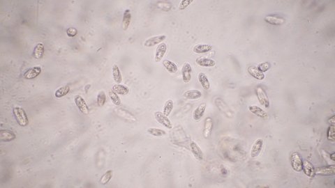 infusoria protista , rotifera, paramecium, microscope
