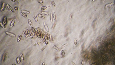 infusoria protista , rotifera, paramecium, microscope
