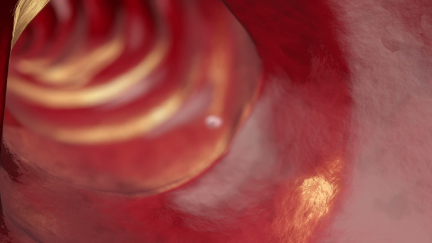 Parasitic worms in the lumen of the lumen, 3D animation. Growth and multiplication of nematode worms invading human intestine
