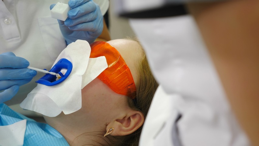 Preparation for professional teeth whitening or bleaching procedure in modern dental clinic. Part of gum isolation and teeth covering for LED whitening. Patient in protective glasses in chair. 4 k, a Healthcare Video by Footager