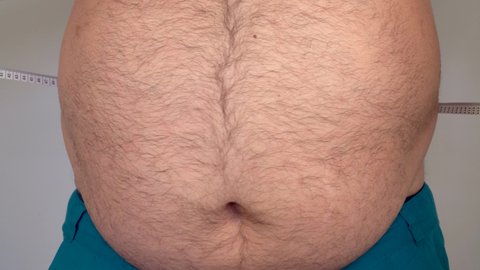 fat guy measures the size of the abdomen with a centimeter measuring tape. the person suffers from excess weight. man with a large and hairy belly