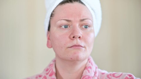 Young woman in pink bathrobe puts cream on pimples on her face against zits, acne, skin rashes and to cure problematic skin and skin imperfections in general