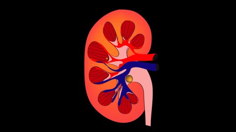 51 Symptoms Kidney Stones Stock Video Footage - 4K and HD Video Clips |  Shutterstock