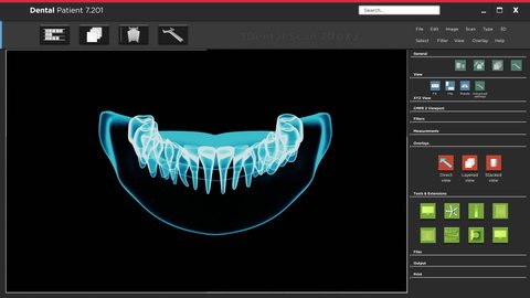 Interface of software app user interface programme with dental xray scan, dental application with maxillary model, concept of dentistry technology. 3D render animation of teeth line or tooth