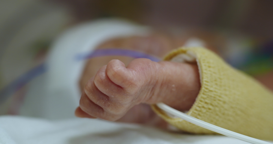 Close-up shot of a small hand of a newborn premature baby. He has thin skin, so the vessels and veins are clearly visible. The kid is dressed in a yellow jacket, pipes are drawn to him Royalty-Free Stock Footage #1070560045