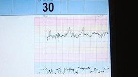 Human healthy monitor shows patient heartbeat health analysis. Using computer in medicine childbirth. Numerical value. Medical device screen closeup. Heart rate monitoring with AI analysis and control - Powered by Shutterstock - Get 15% off with code: PIKWIZARD15