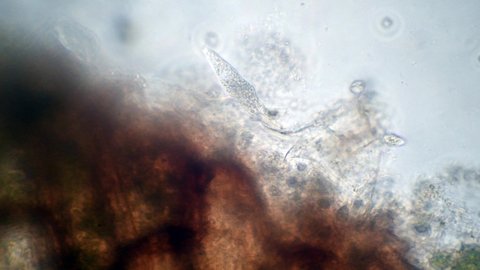  Lacrymaria olor, freshwater microscopic life, Phylum Ciliati, 