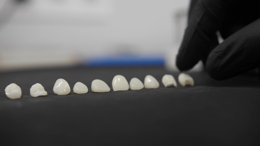 Veneers in dentistry. Artificial teeth | Shutterstock HD Video #1070730868