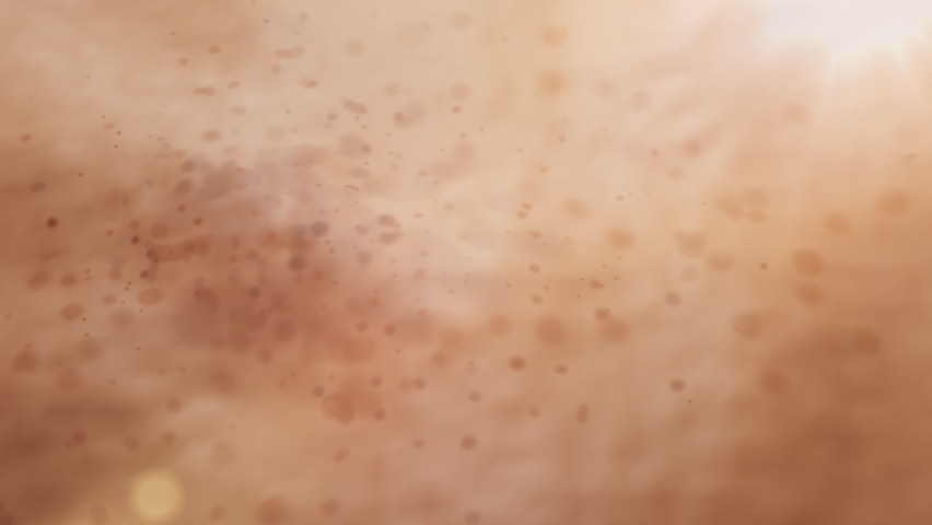 Animation Laser treatment for freckles. Laser Pigmentation Removal. Laser Treatment for Freckles or Age Spots. Spot melasma pigmentation facial treatment on face.  | Shutterstock HD Video #1070948869