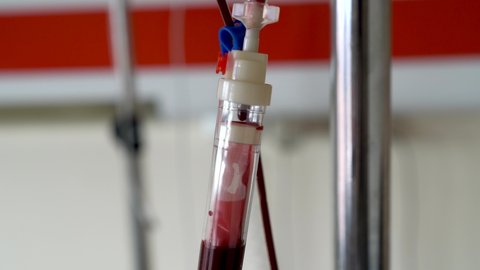 Ankara, Turkey - March 2021: Blood transfusion serum in hospital room with blood drip