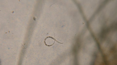 Bacteria Parasites and Worms in drinking Water under Microscope. nematode Worm under Microscope, Parasites Among Roundworms: Roundworms, Pinworms, Trichinella. Environmental Pollution.