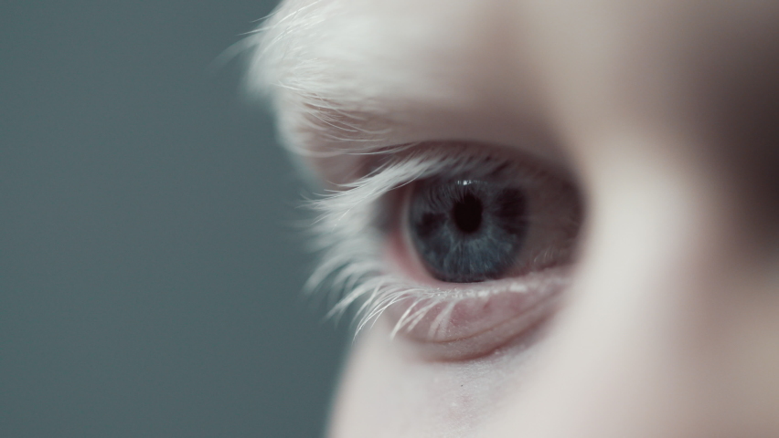 Eye Human with Beautiful Blue Iris Macro Shot. Bright Beauty Boy Open Eyes with Pupil Dilation. Extreme Close-up Blond Kid Clear Looking Forward. Contracting Albinism Skin on Body. View Concept 4k | Shutterstock HD Video #1071425287