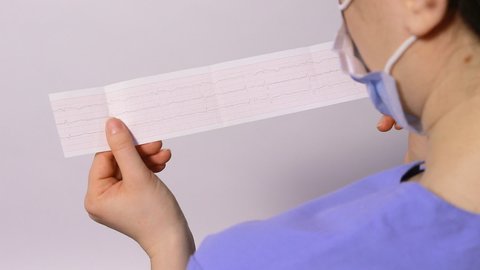 The cardiologist shows the film of an electrocardiogram of a patient with acute myocardial infarction. Heart and cardiovascular disease, cardiology and cardiography