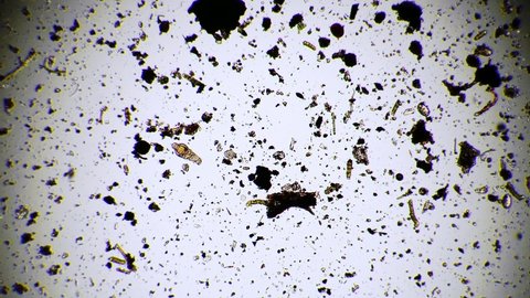 The rotifier is moving in the area full of different microorganisms under microscope. Small animal is creeping in it's own life environment. Theme of small creatures existing in microcosmos