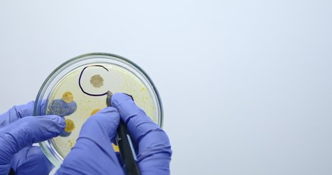 The scientist marks the areas with bacteria in the Petri dish with a felt-tip pen, the close-up.