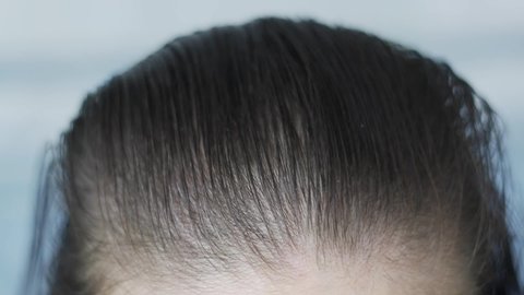Woman keeping comb with hair in hand. Lots of fallen hair on a comb. Hair loss problem, hormonal failure, stress, diet, scalp and hair bulb disease