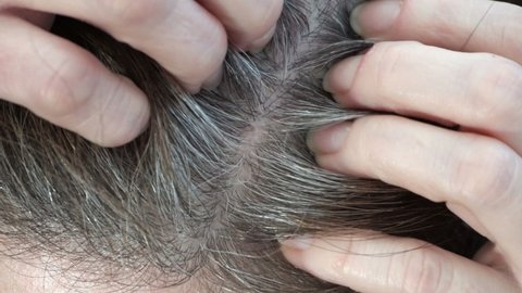 Closeup shot of a middle aged woman itching her scalp in the part of her dyed hair with gray roots.