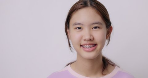 Slow Motion Smiling Happy Dental Braces Of Asian Teenager. Portrait Headshot Beauty Smile With Confidence White Teeth.
