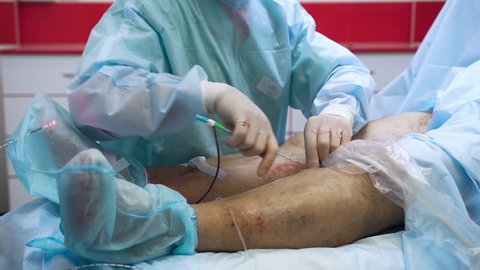Endovasal laser coagulation- surgeon removes varicose veins with laser which glows under patient's skin. Nurse holds bandage around wound to prevent blood from flowing. Innovative method of treatment
