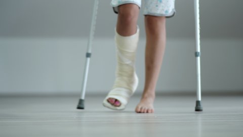 Young woman with crutch and broken leg in cast walking at home, rehabilitation after broken leg accident
