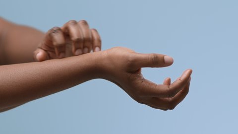 African American Woman Suffering From Eczema Scratching Itchy Hands Over Blue Studio Background. Cropped, Closeup Of Female Arms. Healthcare And Dermatological Problems