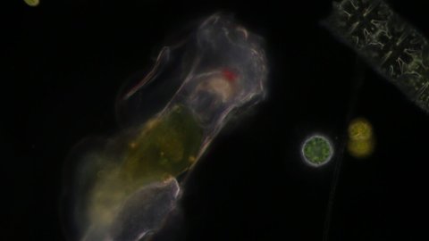 Bacteria,Protozoa and Green Algae in waste water under the microscope.
