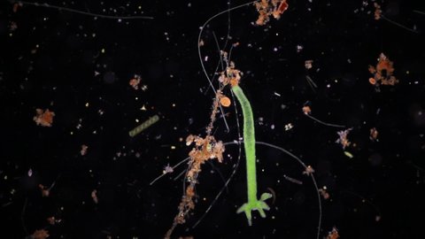 Bacteria,Protozoa and Green Algae in waste water under the microscope.
