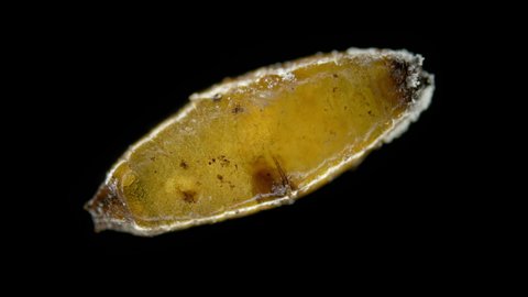 Colony Soil mites family Acaridae under microscope. In an old cocoon of Lumbricidae worms, saprophages feed on rotten organic debris, mold. There are types of pests that damage flower bulbs and grains