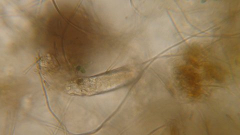 Bacteria Parasites and Worms in drinking Water under Microscope. nematode Worm under Microscope, Parasites Among Roundworms: Roundworms, Pinworms, Trichinella. Environmental Pollution.