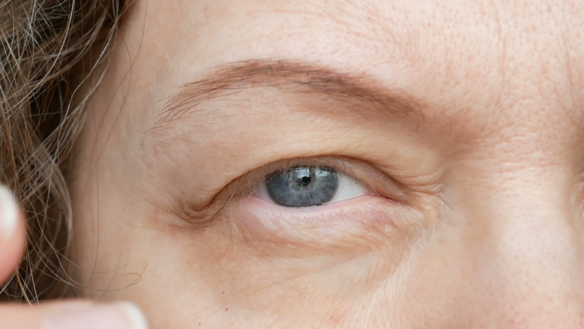 Middle-aged woman does corrective eye makeup to correct the drooping eyelid. Ptosis is a drooping of the upper eyelid, lazy eye. Cosmetology and facial concept | Shutterstock HD Video #1073190617