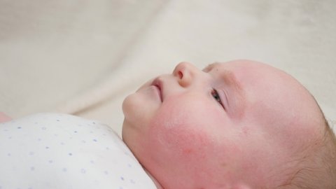 Little baby boy suffering from dermatitis and acne on face skin cured with moisturizing lotion and medical ointment. Concept of newborn baby hygiene, health and skin care.