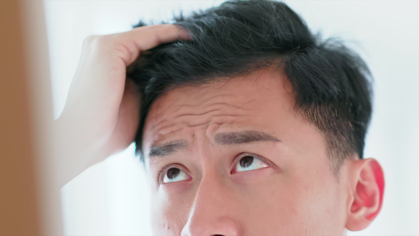 Man worry about hair and check the hairline | Shutterstock HD Video #1073552042