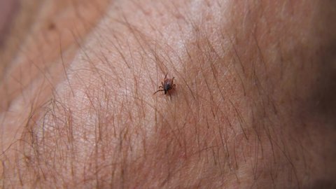 A forest tick crawls on a man's hairy arm. Macro. Blood-sucking insect on the human body close-up