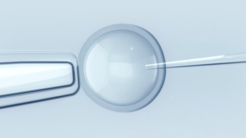 In vitro fertilization. View from a microscope, embryologist performing sperm Injection. Intracytoplasmic sperm injection. Loopable.