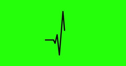 48 Irregular Heart Beat Stock Video Footage - 4K and HD Video Clips |  Shutterstock