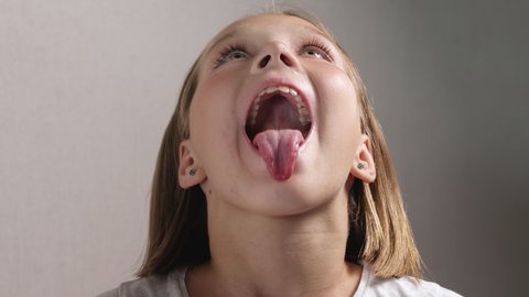 Cute school-age girl at an appointment with a doctor, a jaw surgeon or an orthodontist. Child opens his mouth wide and sticks out his tongue for inspection. Close-up