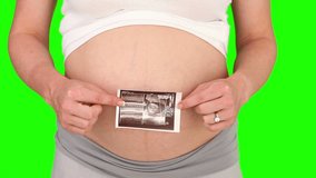 Chromakey footage of a pregnant woman showing us a scan of her future baby