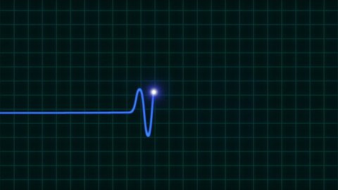 An animated EKG heartbeat monitor in blue wave line (one beat). Audio is included. Full HD footage