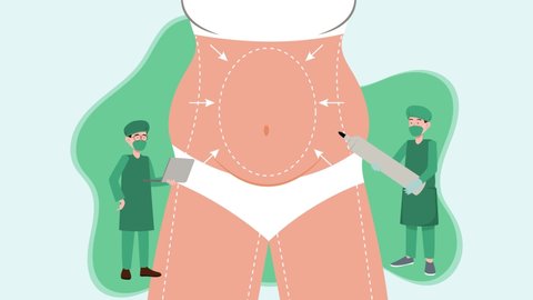 34 Plastic Surgery Cartoon Stock Video Footage - 4K and HD Video Clips | Shutterstock 34 Plastic Surgery Cartoon Stock Video Footage - 4K and HD Video Clips | Shutterstock