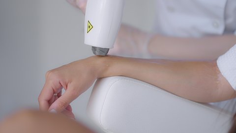 close-up. laser hair removal under the armpit of a beautiful girl in a beauty salon. Woman having underarm Laser hair removal epilation. Laser treatment in cosmetic salon