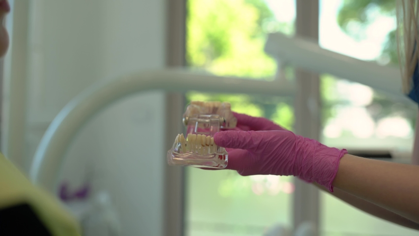 Close-up of dentist holding jaw model with implanted teeth.