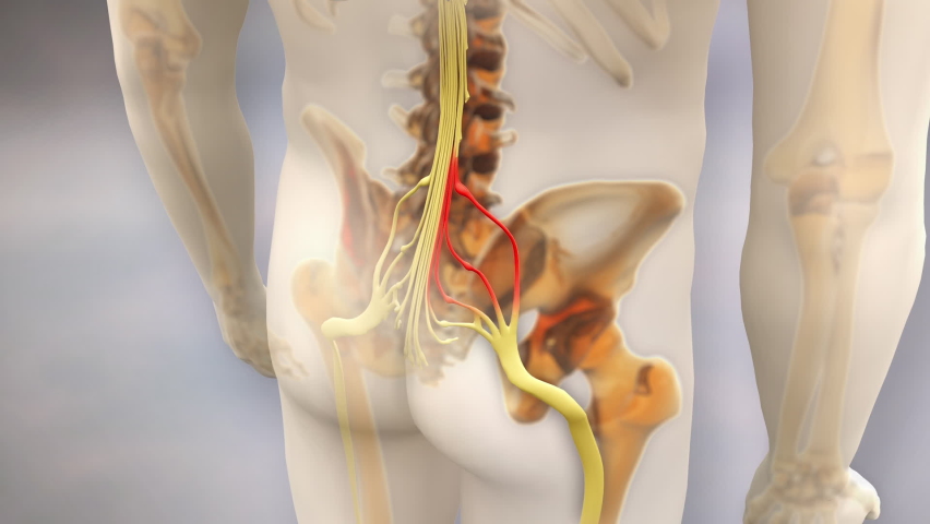 Sciatic Nerve Pain 3d animation rendering | Shutterstock HD Video #1075458824