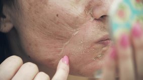 4k close up video of woman having skin problems looking in the mirror.