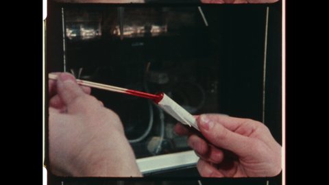 1980s Chicago, IL. Clinical Laboratory Assistant in Medical Laboratory Analyzing Blood Samples on Testing Machine. Close Up of Test Tube full of Blood . 4K Overscan of Vintage Archival 16mm Film Print