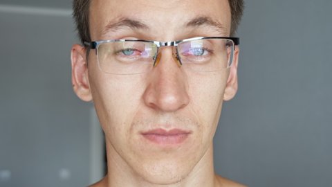 Man takes off glasses from reddened eyes.