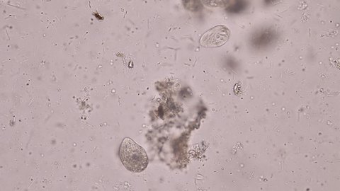 Bacteria and Protozoa in waste water under the microscope.