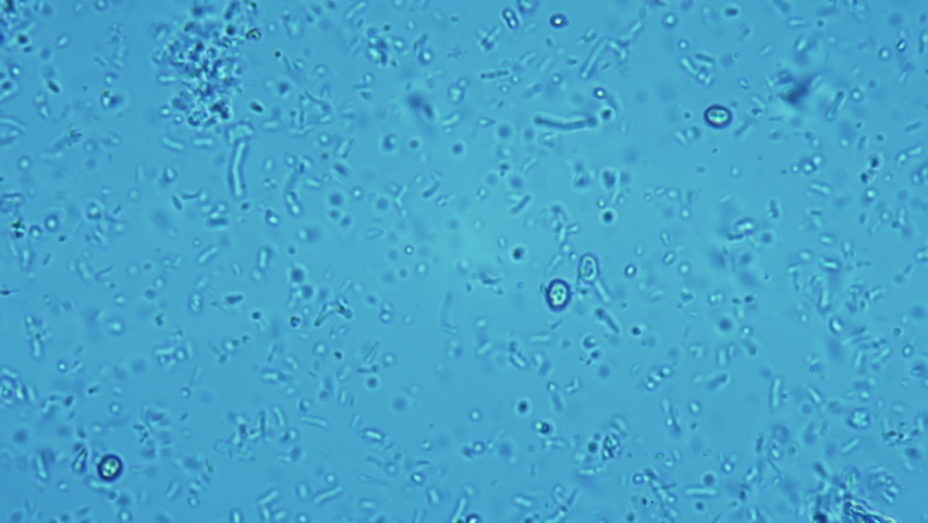 Human dental plaque under a microscope. Thousands of different bacteria are visible in the frame. Staphylococcus, Streptococcus, Candida and yeast bacterias in the frame Royalty-Free Stock Footage #1076231237